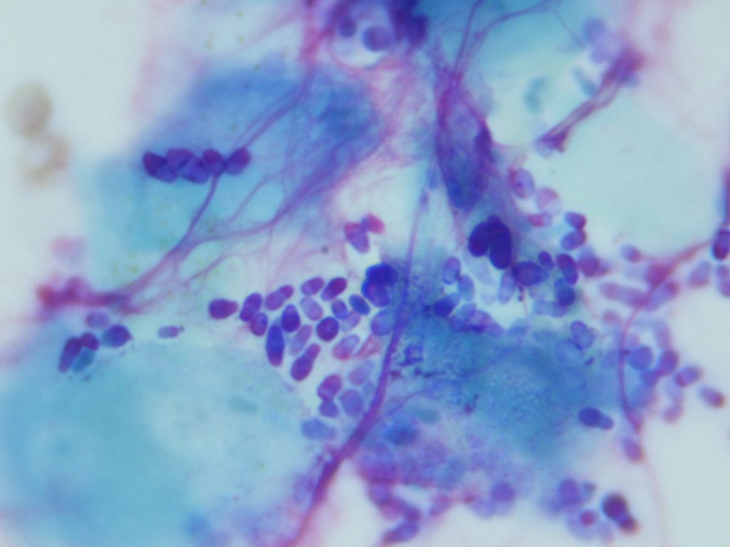 The Delicate Scalp Microbiome Balance: Why Malassezia Isn't The Enemy