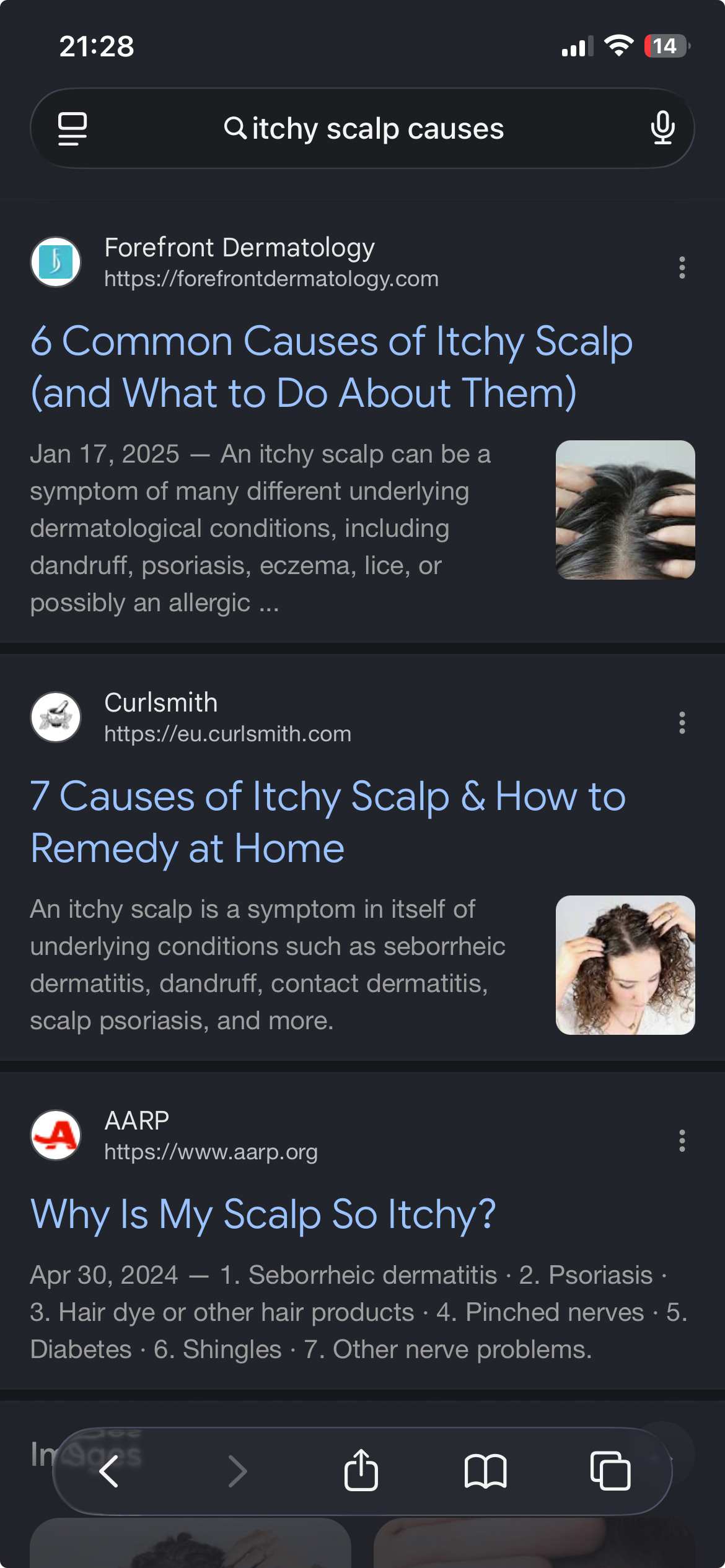 Phone screenshot showing Google search results for itchy scalp causes